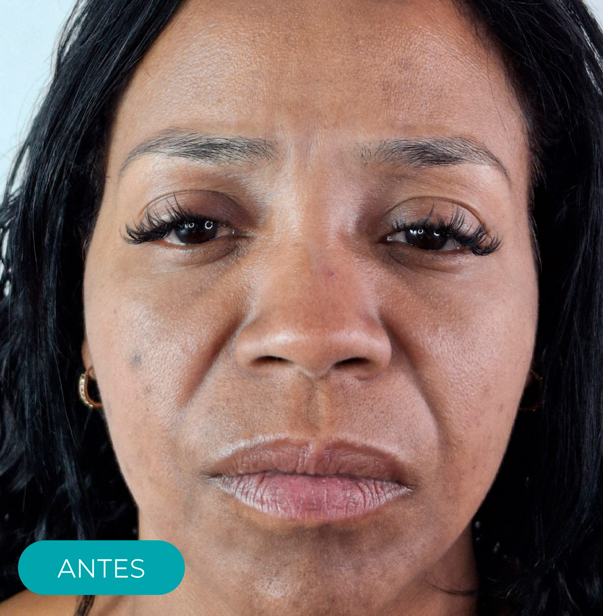 antes